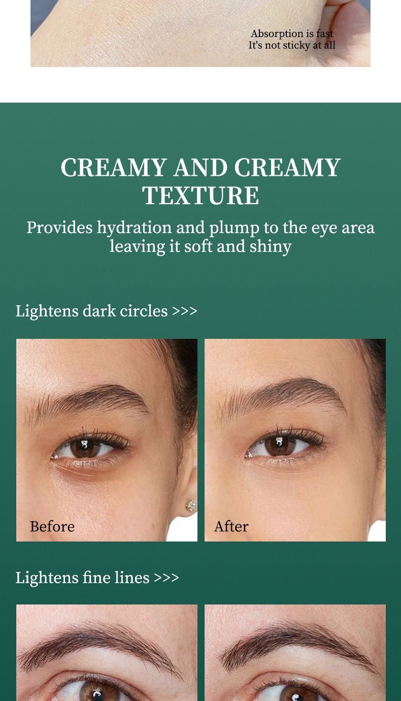 Tienes ojeras, hinchados?Esta crema es para ti.