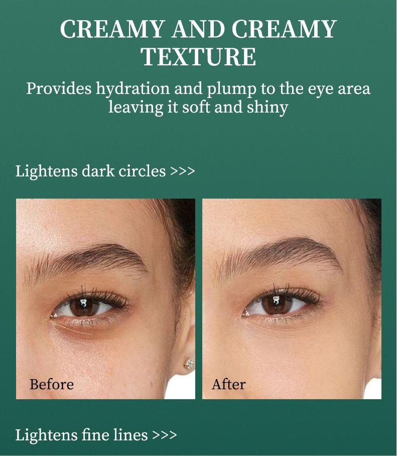 Tienes ojeras, hinchados?Esta crema es para ti.