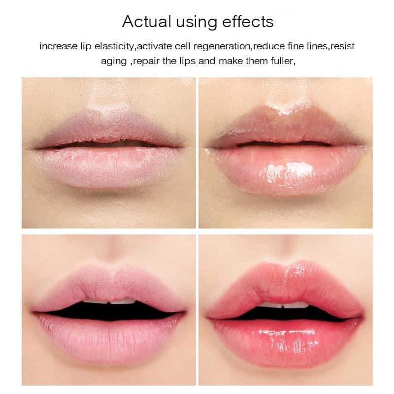 Serum Labios